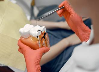 Treatment of Dental Cavities